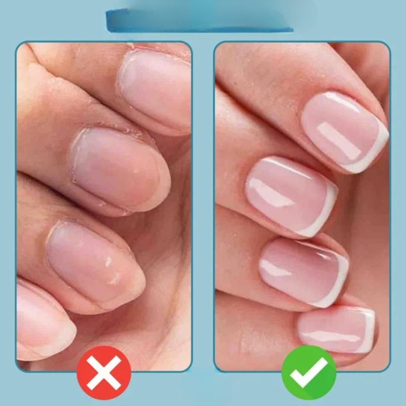 1+1 Gratis | NailCarePro - 3-in-1 Nagelhautöl-Stift mit Keramikspitze